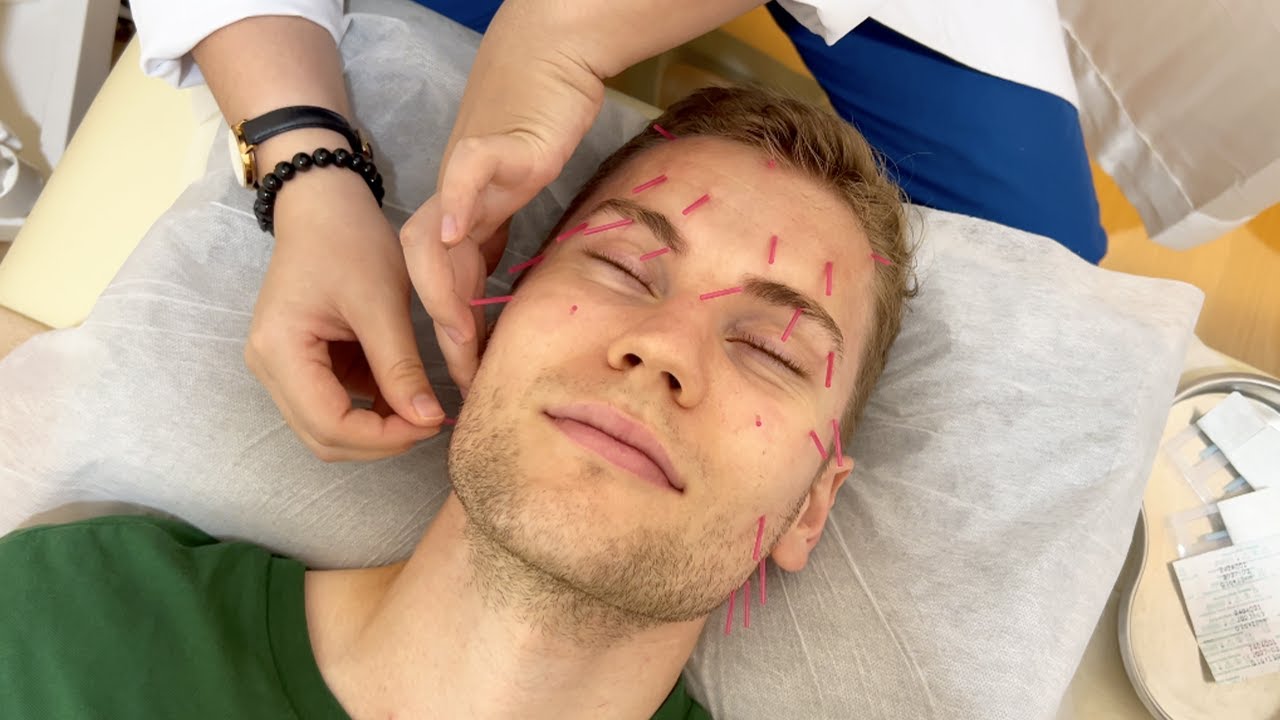 FACIAL ACUPUNCTURE MASSAGE for Anti Aging and Glowing Skin 🪡