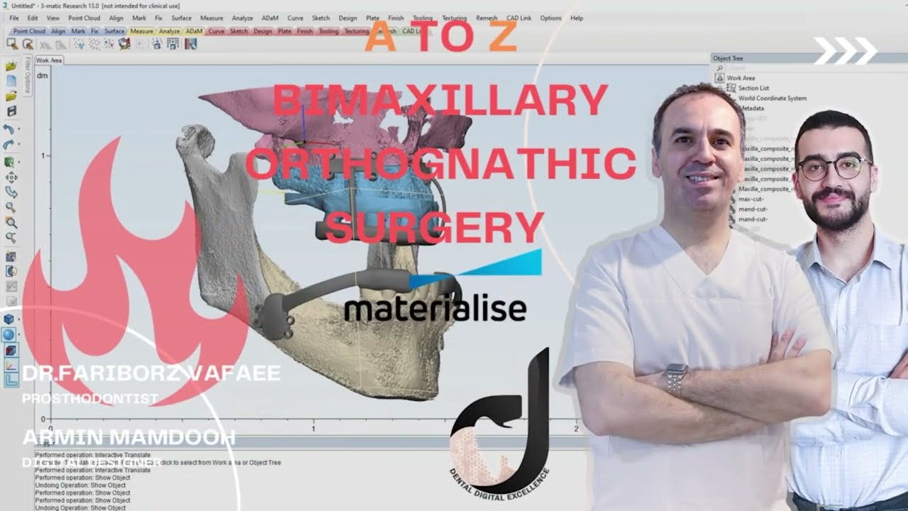 A To Z bimaxillary orthognathic surgery with materialise🔥