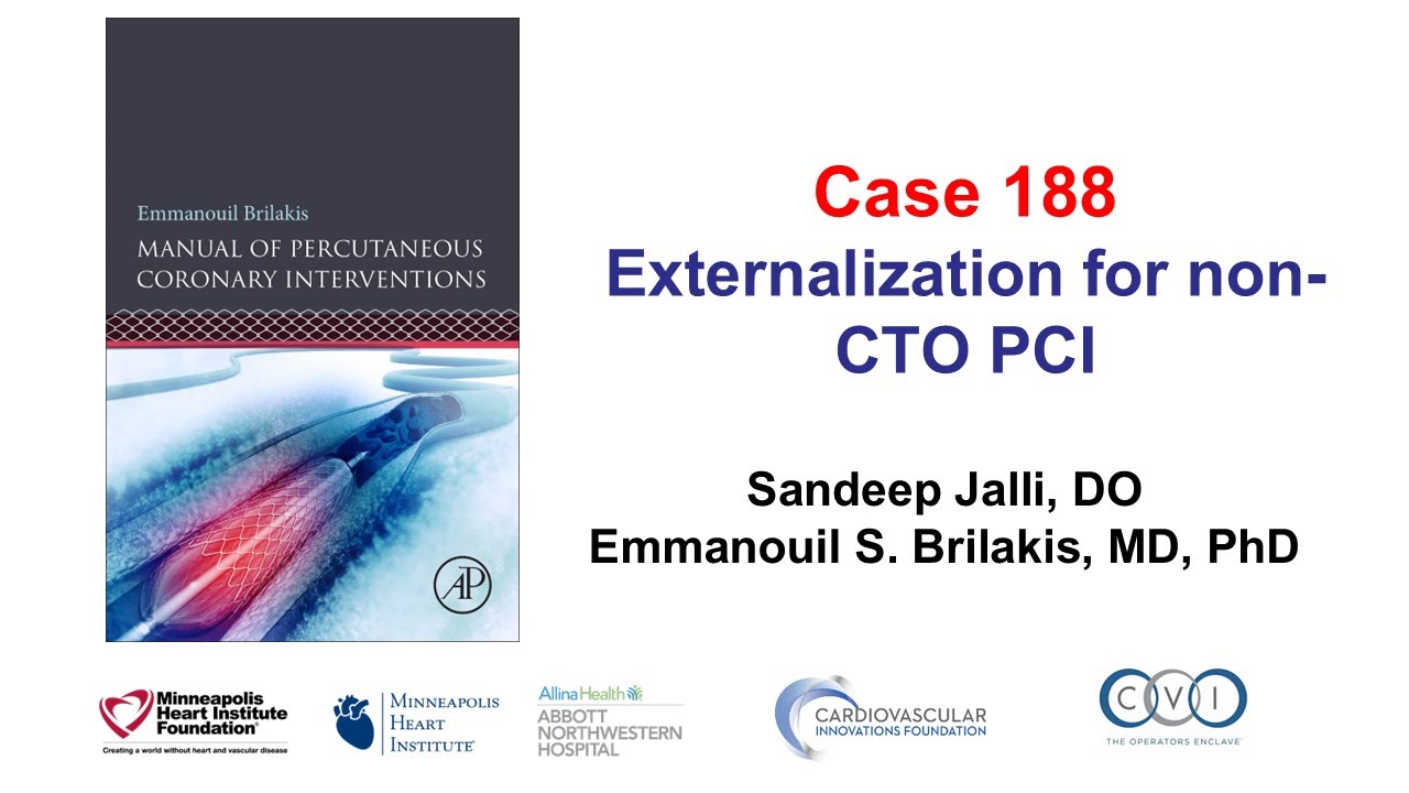 Case 188: Manual of PCI - Externalization for non-CTO PCI