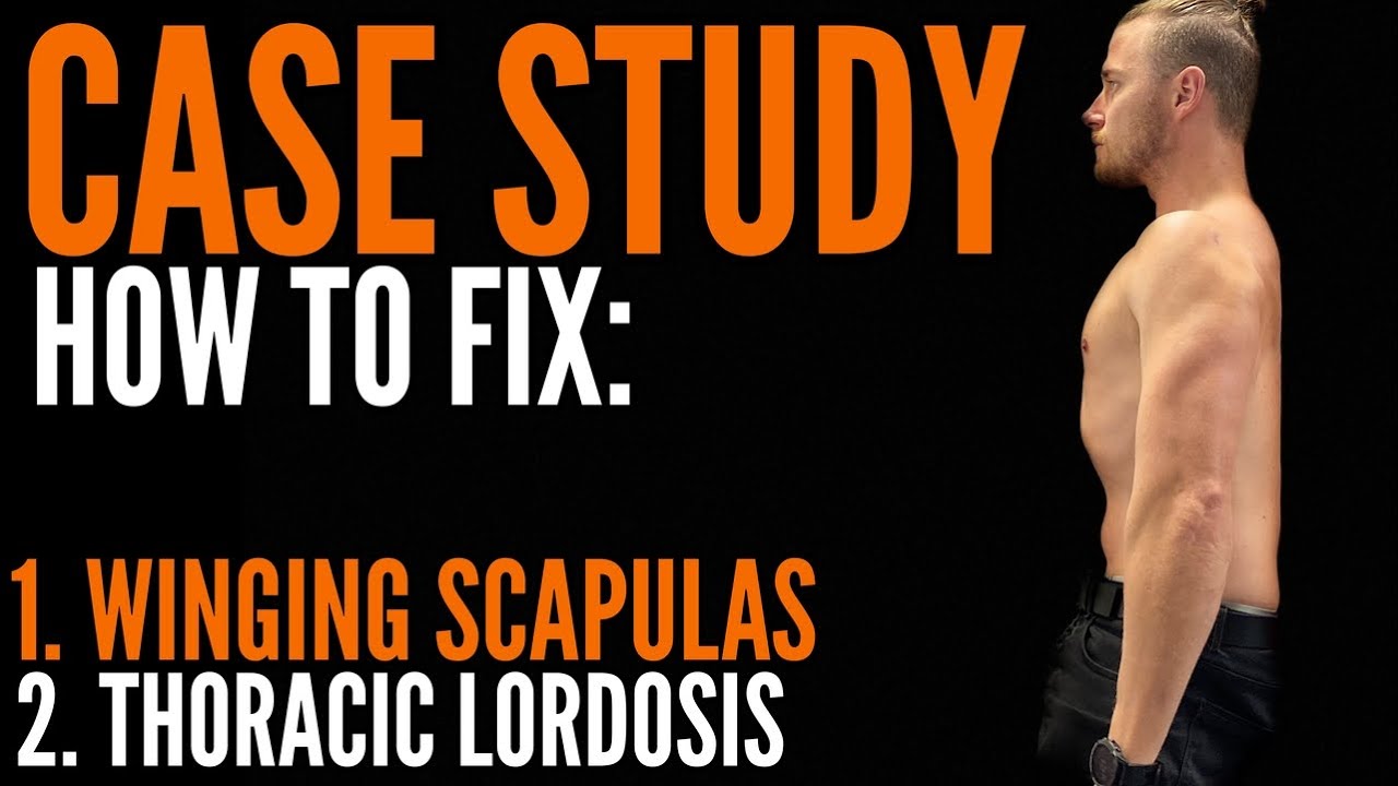 HOW TO FIX: Winging Scapulas and Thoracic Lordosis