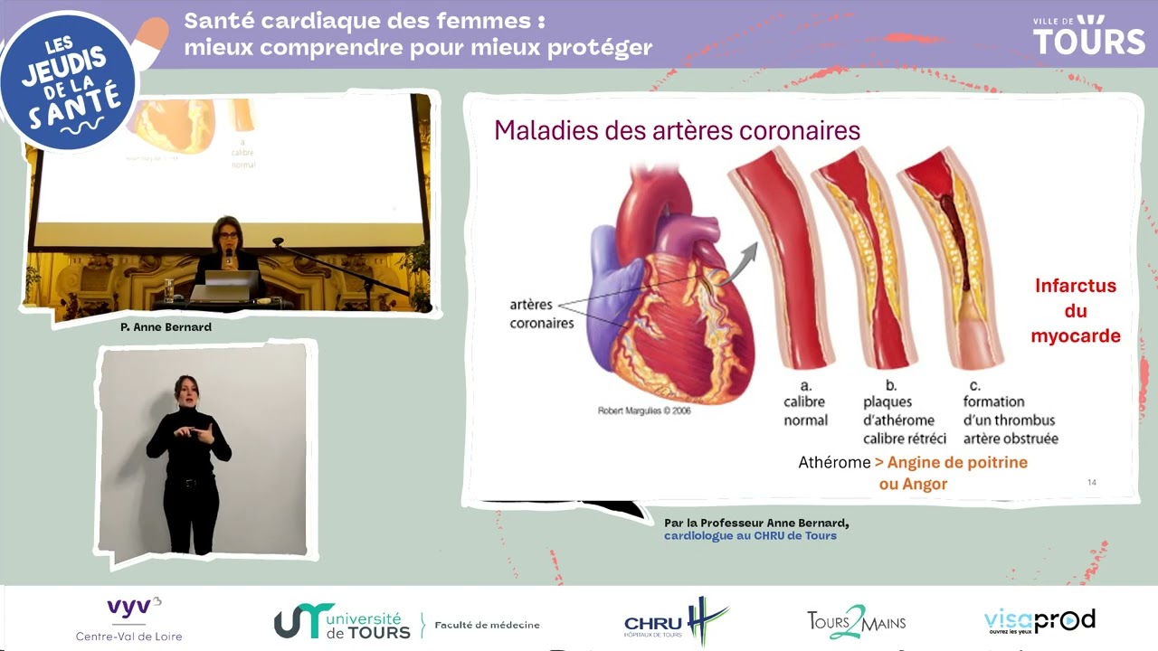Jeudi de la santé - 