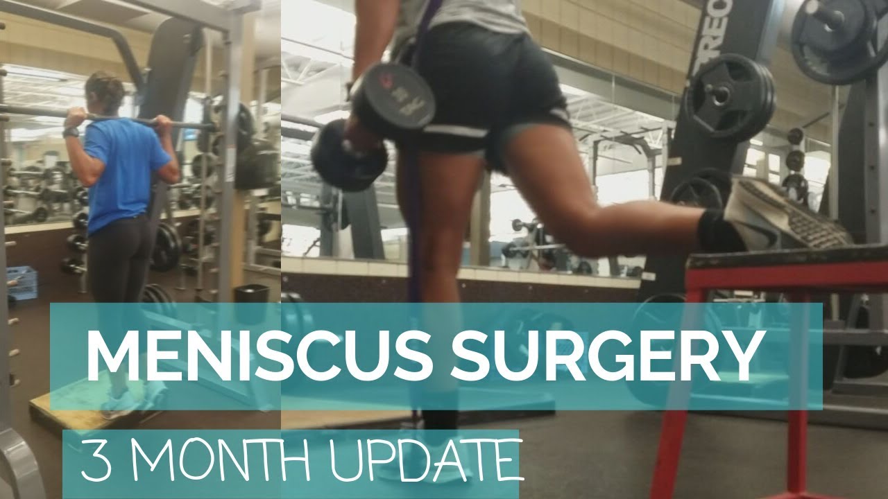 Meniscus Surgery (partial meniscectomy) Recovery Vlog: Month 3 Post Op Update + Playing Soccer Again