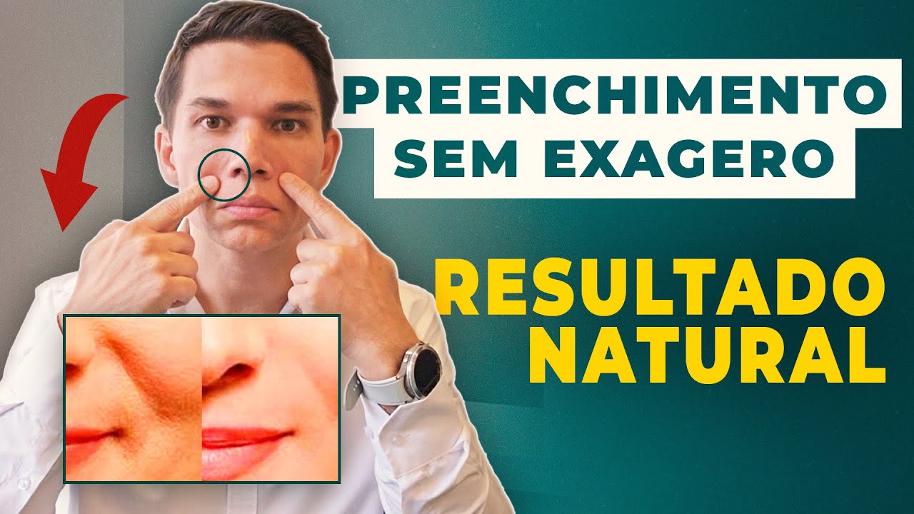 ✨ Preenchimento Rejuvenesce? Como Ficar Mais Jovem SEM Cirurgia!