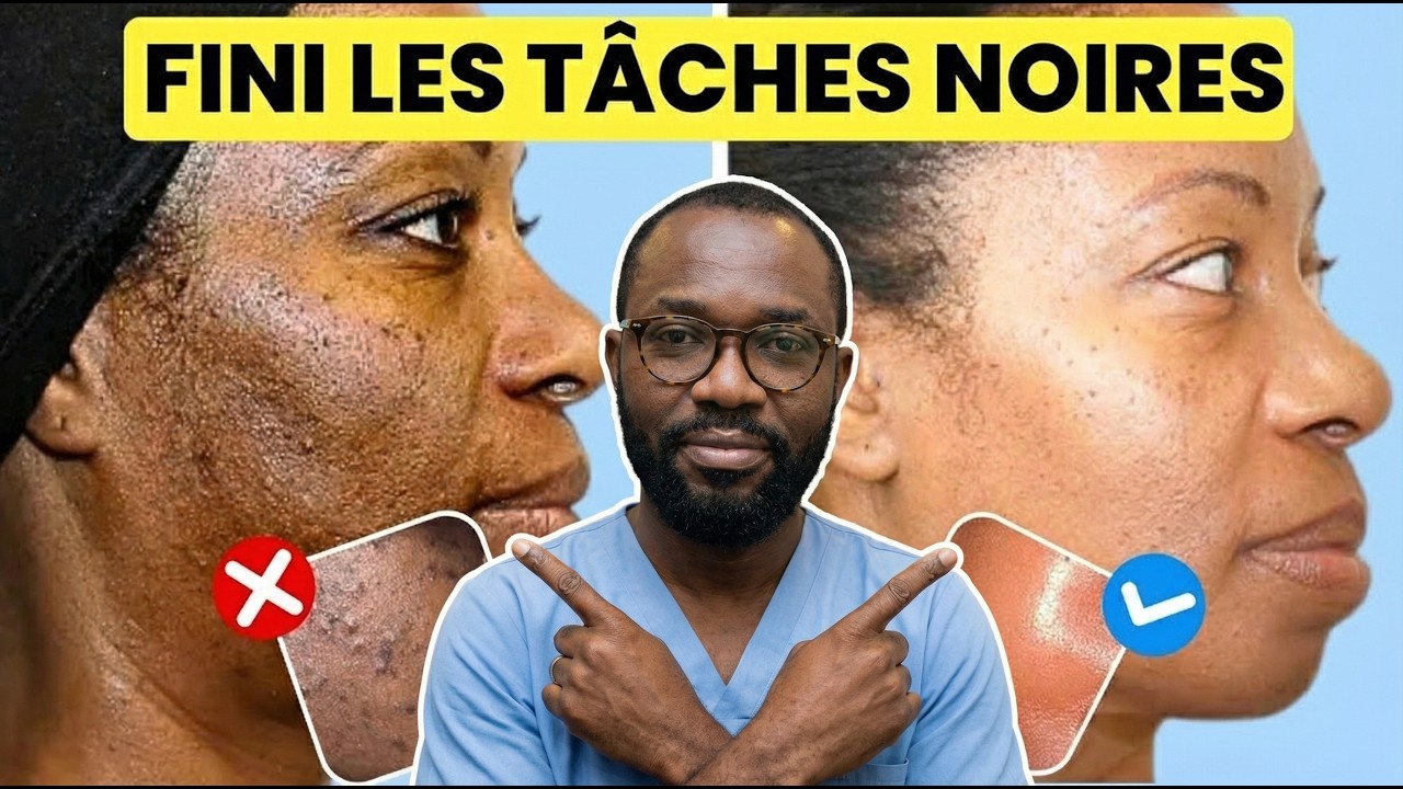 Pourquoi tes taches reviennent toujours (et comment les effacer d&eacute;finitivement)