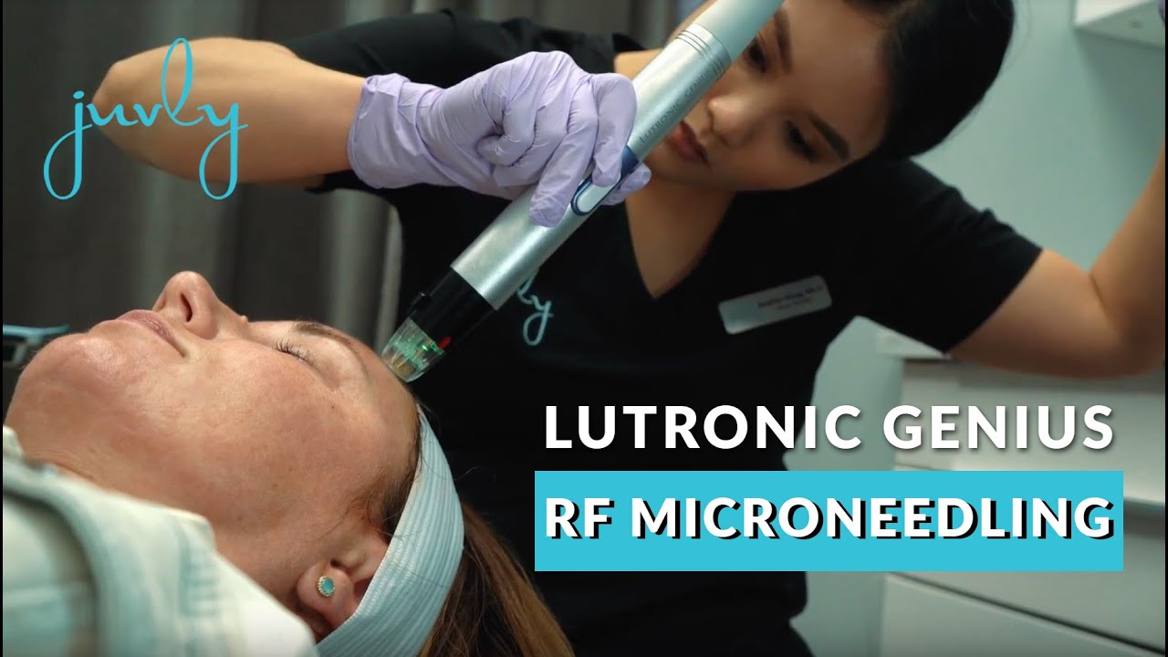Lutronic Genius RF Microneedling | Juvly Aesthetics