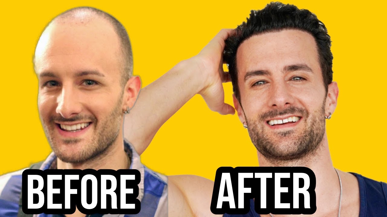 FINALLY, Not Going Bald is Easy!