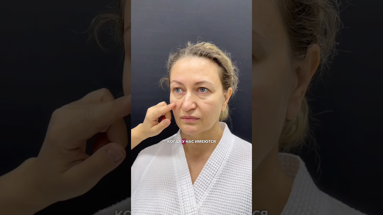 Swimming made my hernias worse. Periorbitoplasty 👀 Plastic surgeon SANDARA NIKOLAEVA