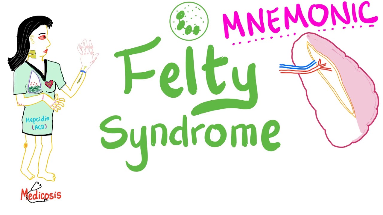 Felty Syndrome (Mnemonic) - Rheumatoid Arthritis- Rheumatology Series