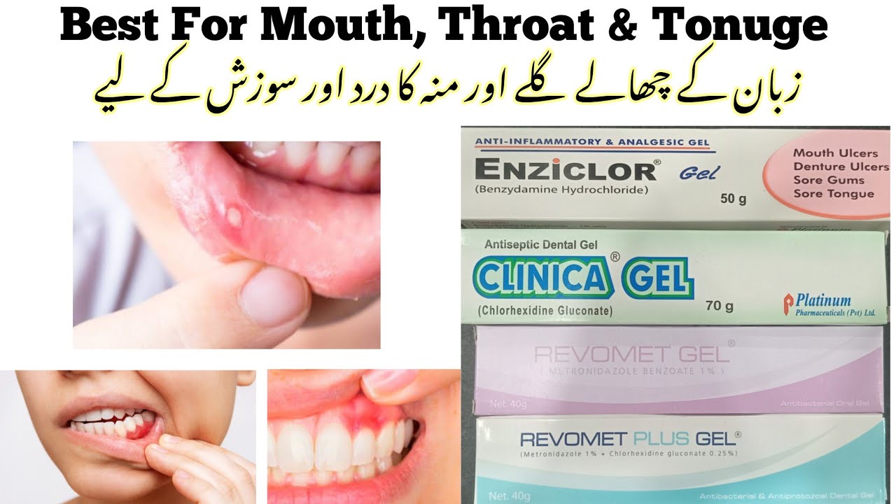 Mouth & Denture Ulcers | Sore Gums & tonuge, Enziclor, Clinica & Revomet Gel Review Uses and Dosage