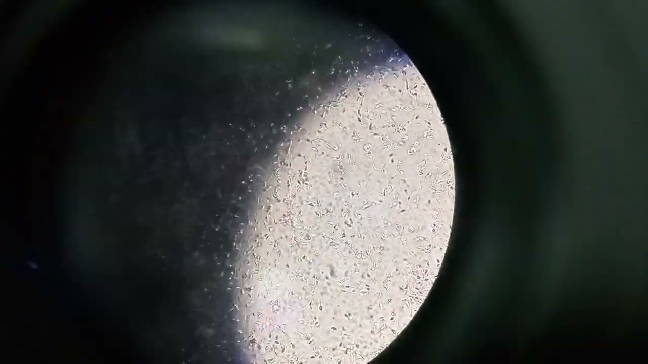 Clumping of sperm present