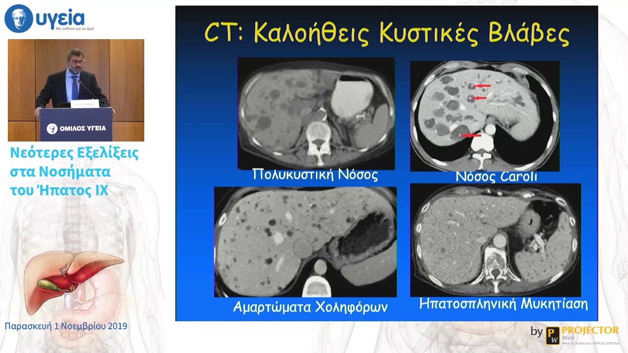 Σύγχρονη ακτινολογία & ήπαρ: Κατάλληλη ακτινοδιαγνωστική τακτική στα νοσήματα του ήπατος | Ρουσάκης
