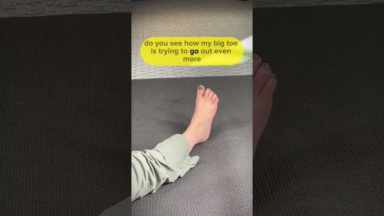 Best Exercise to Fix a Bunion 🦶🏼