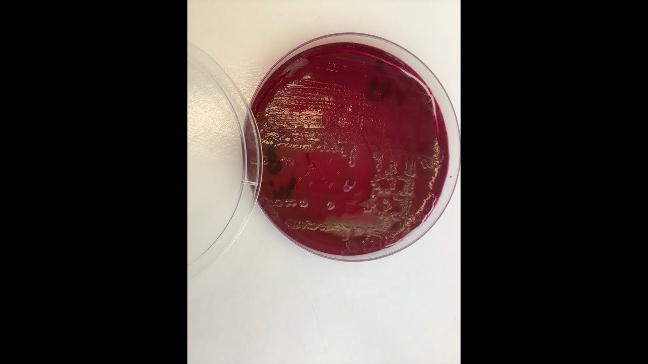 Кишечная палочка &mdash; Escherichia coli (E. coli). Методы лабораторной диагностики (посев, определение)