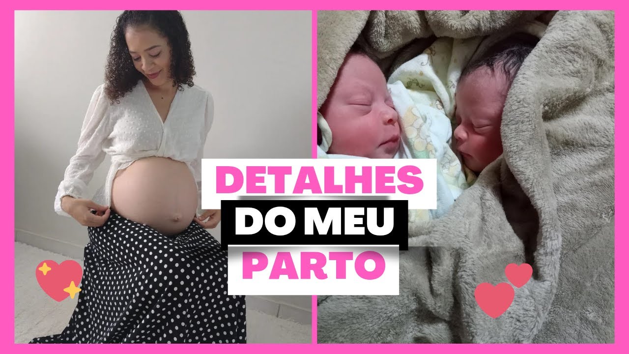 Meu relato de PARTO GEMELAR || CES&Aacute;RIA pelo SUS || 37 semanas
