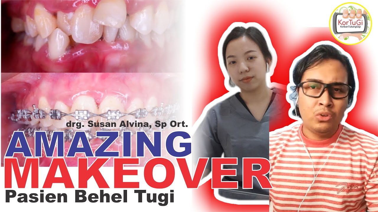AMAZING MAKEOVER Perubahan Drastis Pasien Behel Tukang Gigi