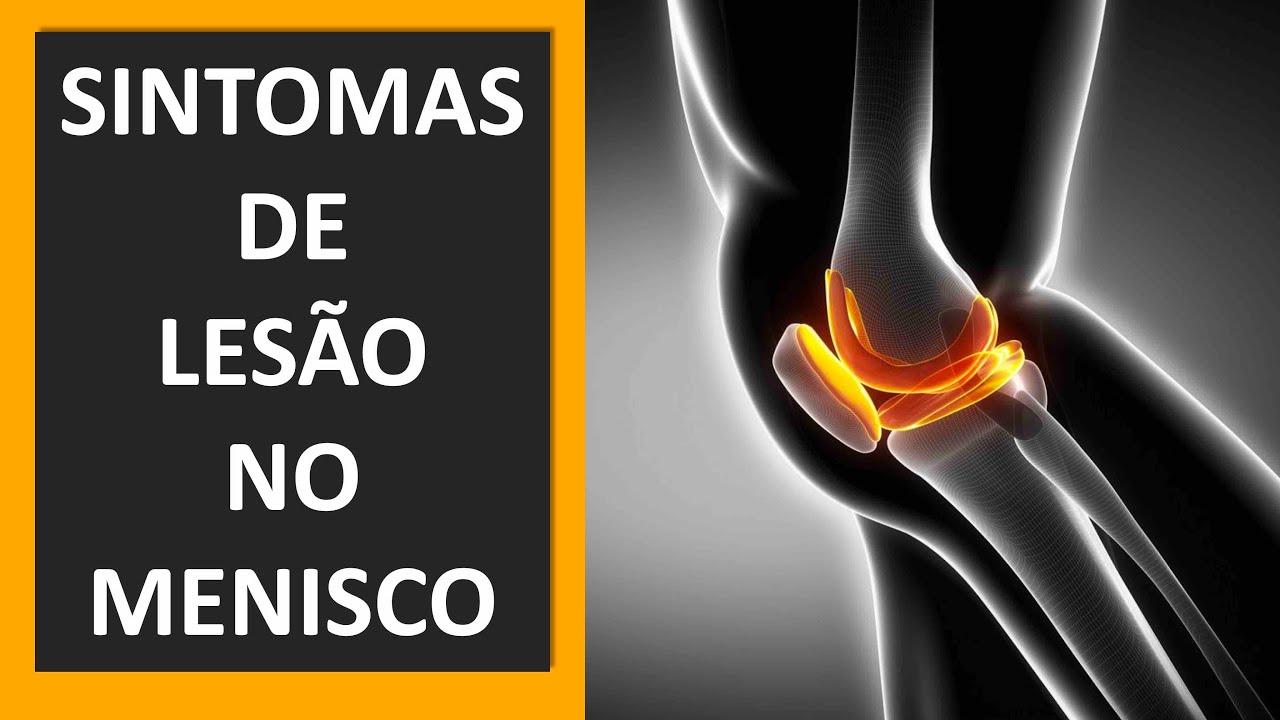 SINTOMAS DE LESÃO NO MENISCO