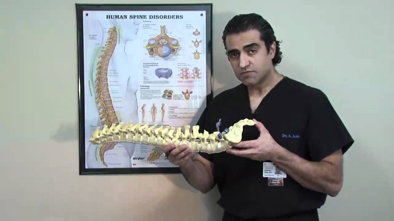 Spine Treatment Center - Radio Frequency Ablation-Facet Block, Non-Surgical