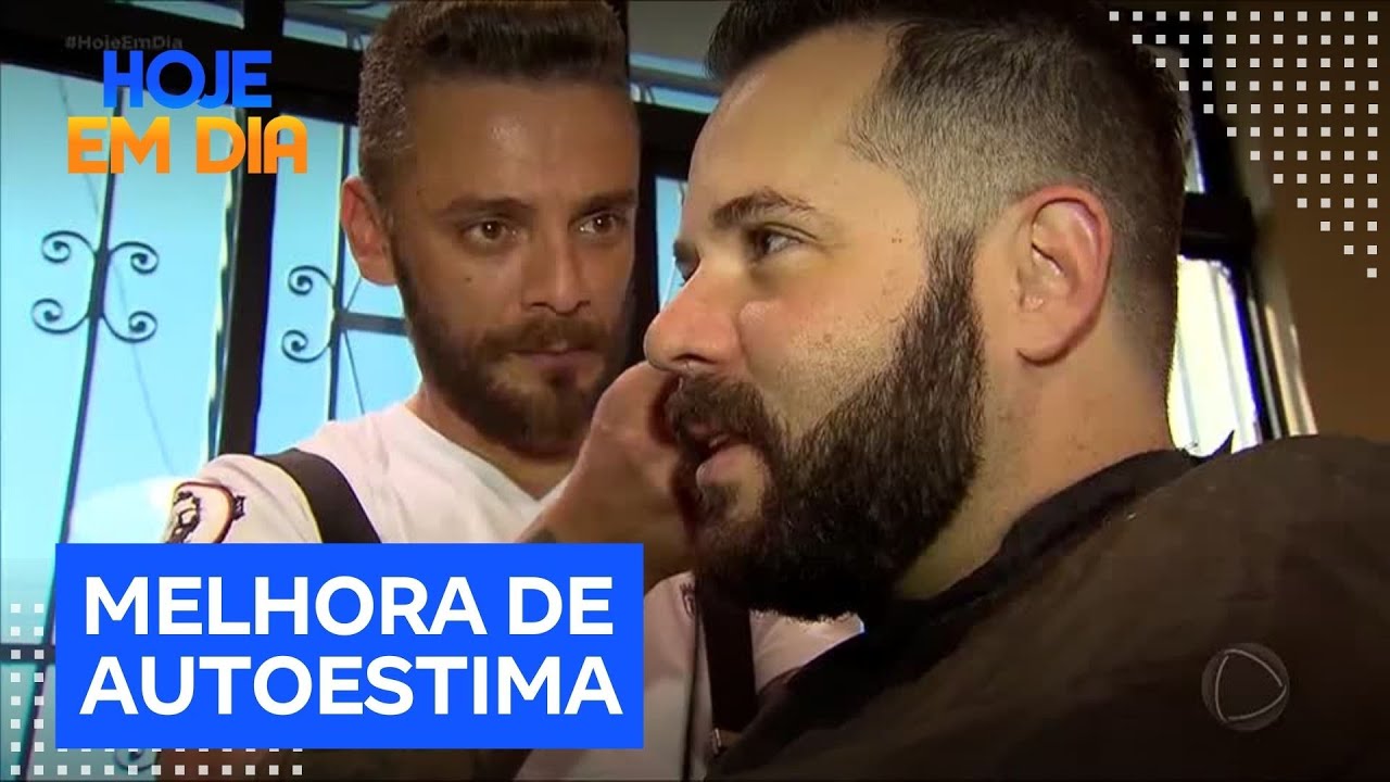 Transplante de barba: conheça a nova tendência entre homens