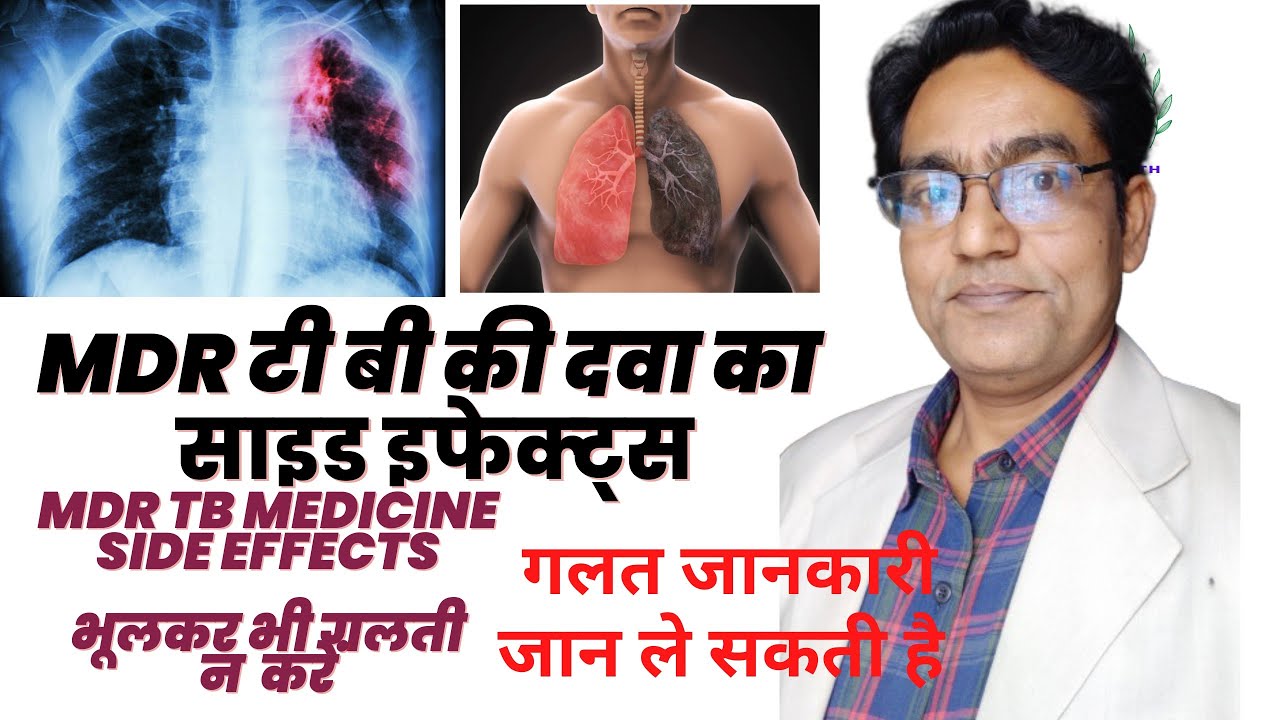 mdr tb medicine side effects in hindi | mdr drug side effects | mdr tb treatment side effects