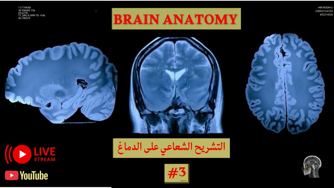 التشريح الشعاعي على الدماغ #3 الشرح يبلش دقيقة 11:28