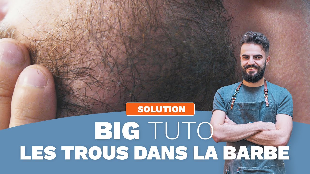 BIG TUTO - Que faire de ses TROUS DANS LA BARBE