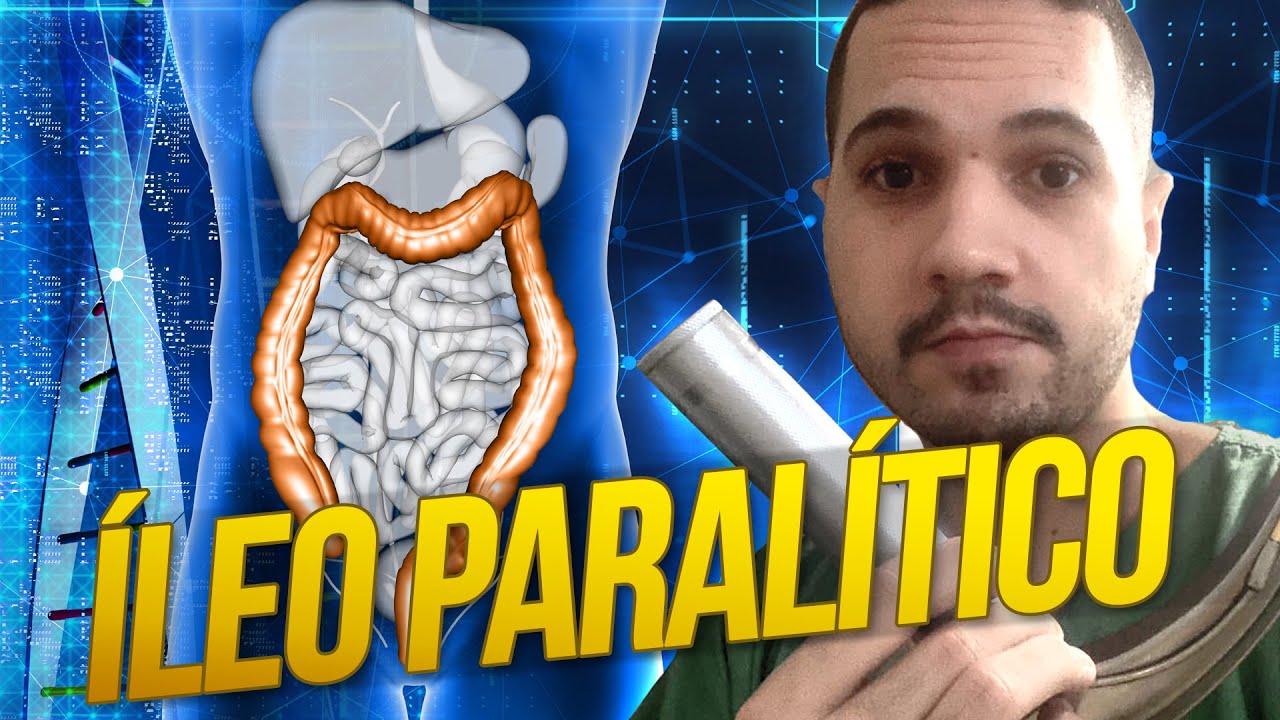 Manejo de Pacientes com &Iacute;leo Paral&iacute;tico *PASSO A PASSO*