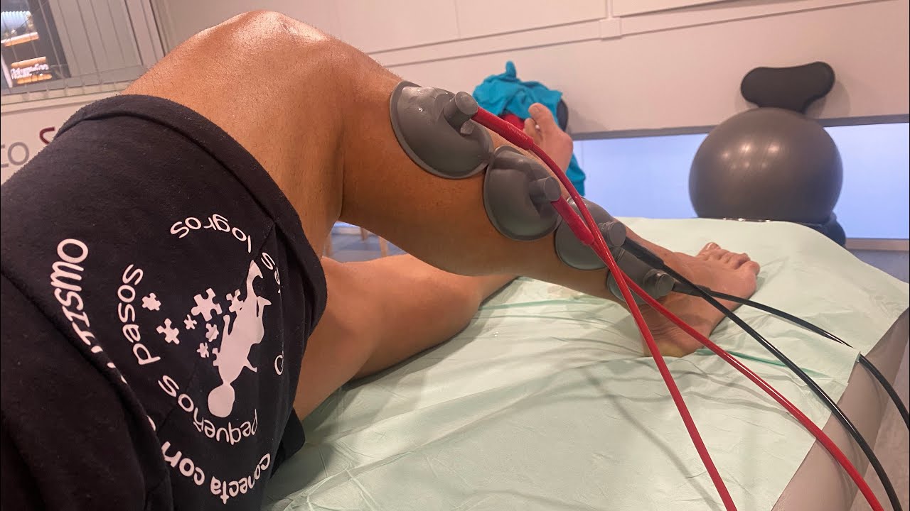 Recuperaci&oacute;n de Rotura del ligamento del Peroneo Astragalino Anterior