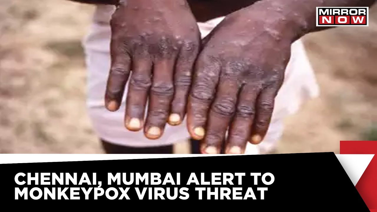Monkeypox Threat | TN Health Secretary asks district officials to be prepared for Monkeypox