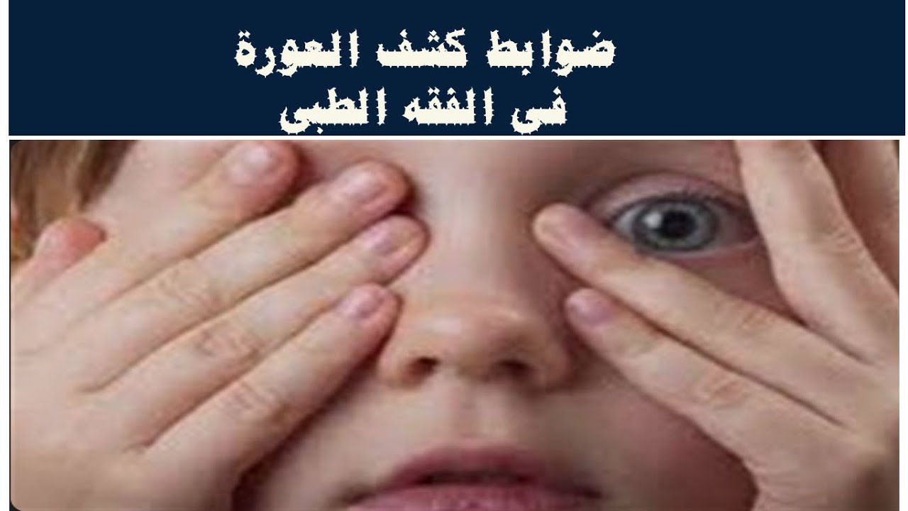 الحلقة 17 ضوابط كشف العورة فى الفقه الطبى