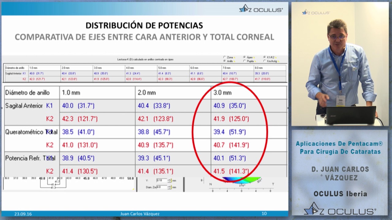 APLICACIONES DE PENTACAM PARA CIRUGÍA DE CATARATAS
