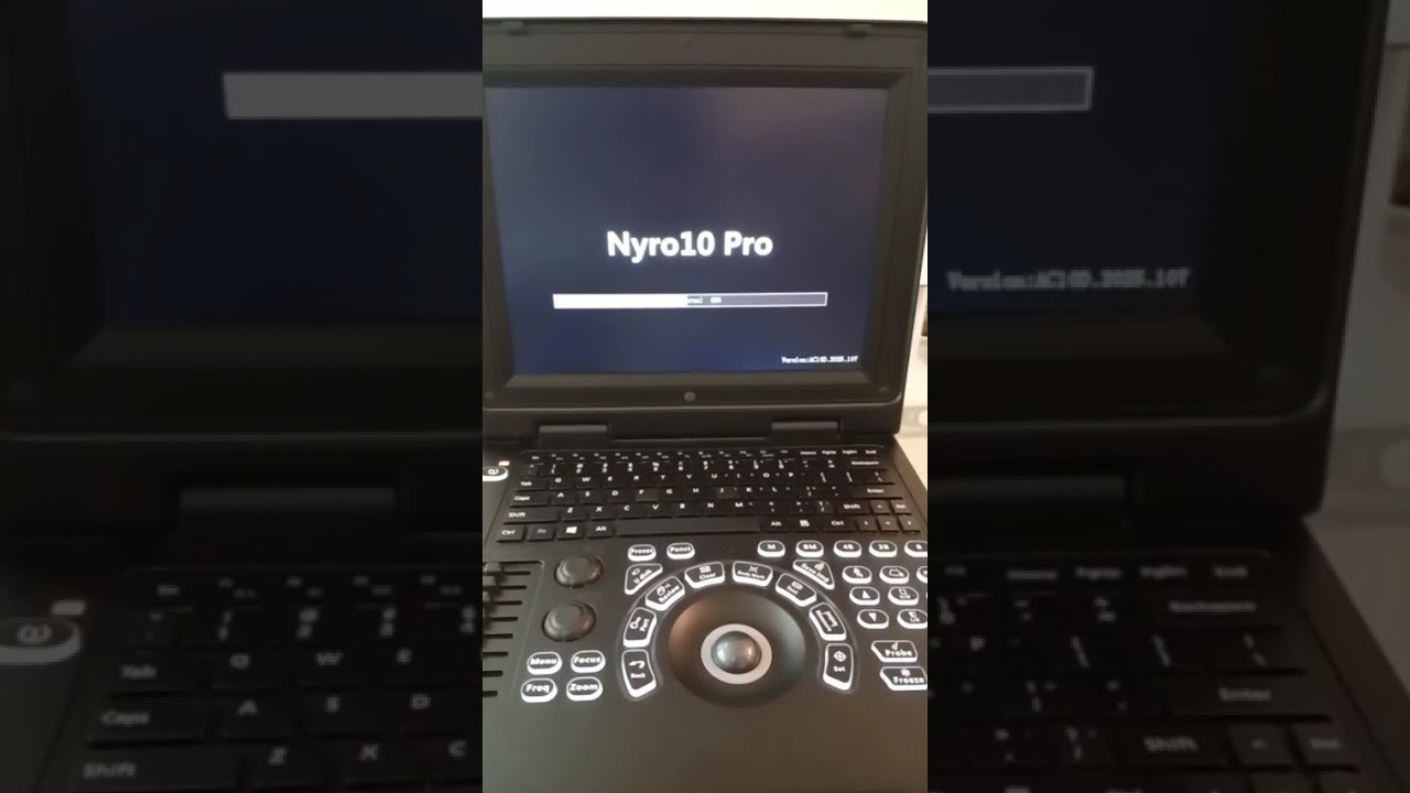 Function Part1 NYRO 10 PRO Best Ultrasound machine and prices by Sonotech