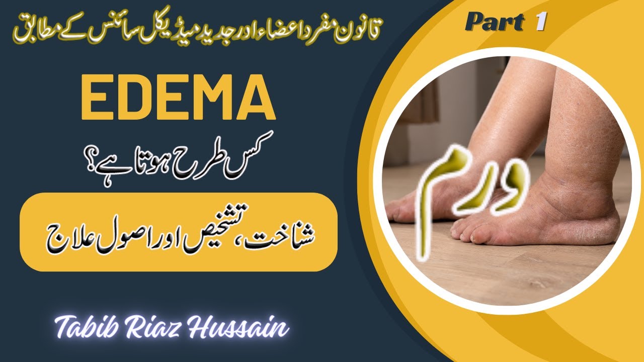 Edema lecture in Urdu Hindi P1 | Edema v/s Inflammation | Hydrostatic and Osmotic Pressure | Albumin