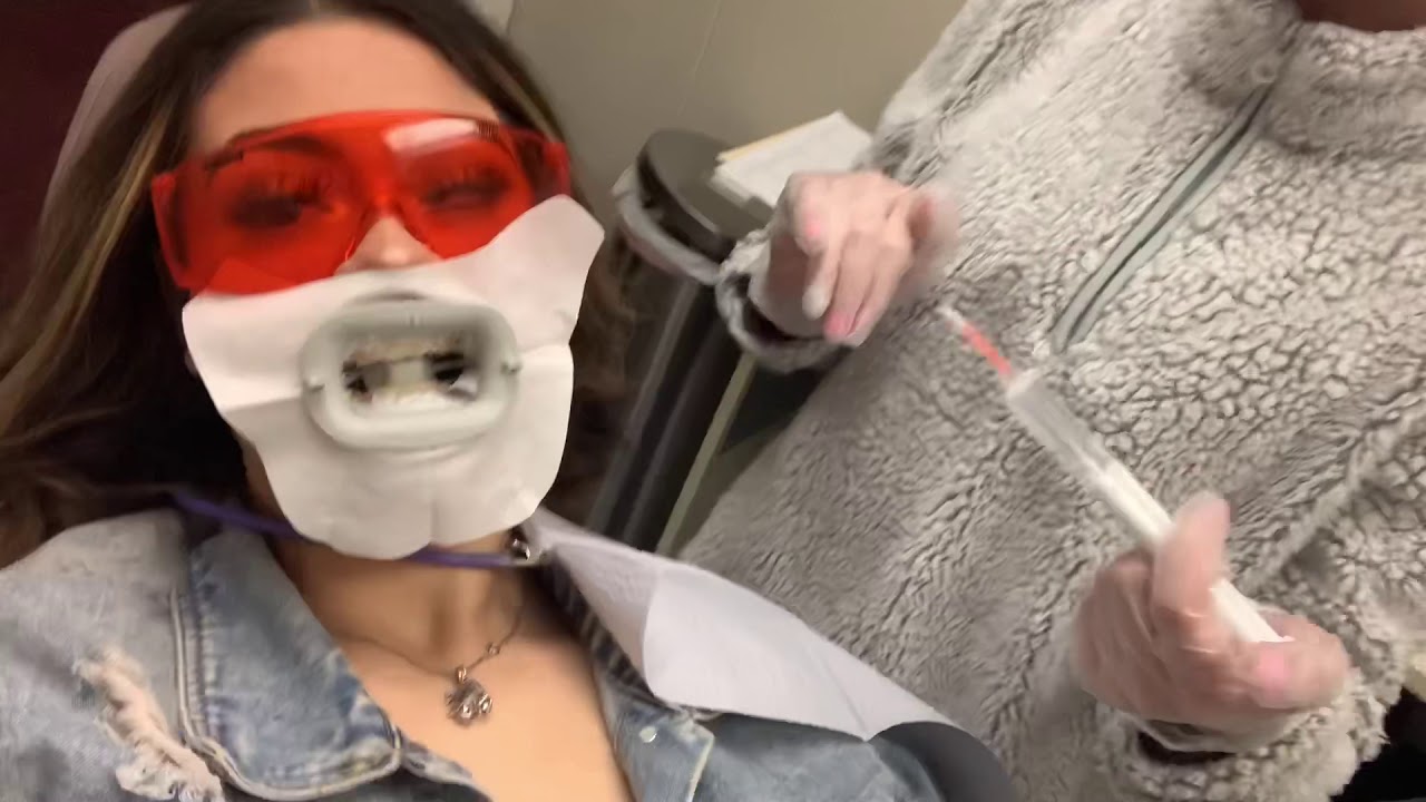 GRWM TO GO GET MY TEETH WHITENED 😬