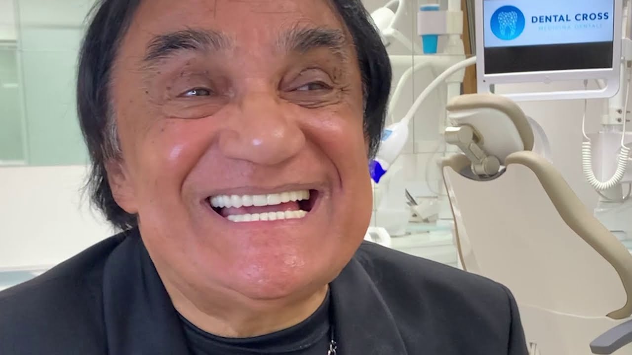Aleksandar, France | Hollywood Smile Review Before & After