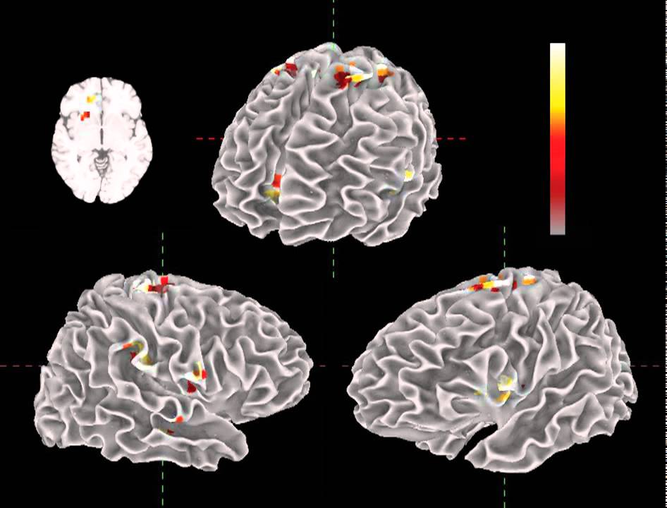 Dynamic Emotional and Neural Responses to Music