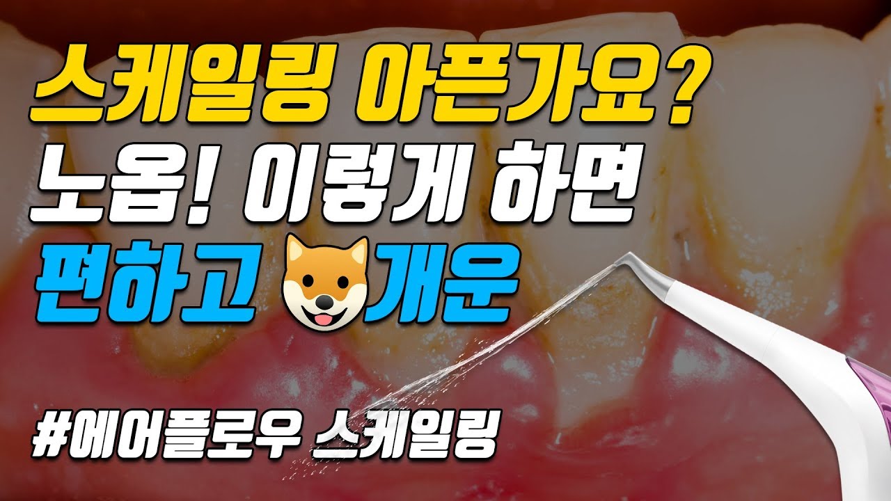 스케일링 아픈가요? 아프지 않고 편하고 개운하게 하기!! 에어플로우 스케일링!