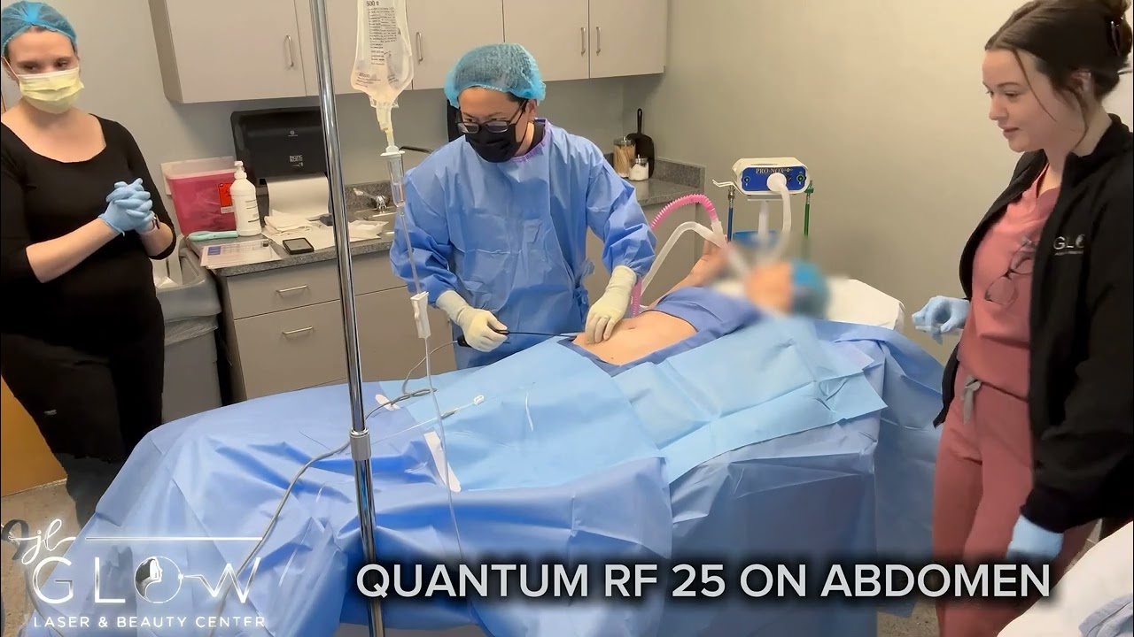 QuantumRF 10 & 25 Patient Walkthrough