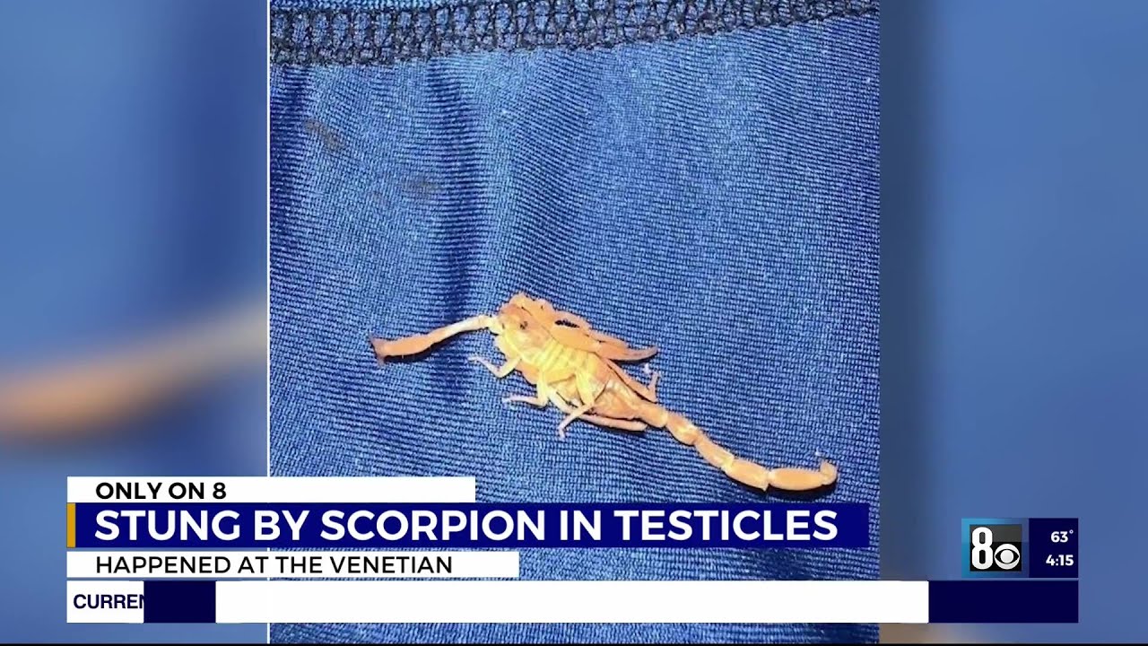 Man stung in testicles by scorpion while sleeping at Las Vegas Strip resort, victim says