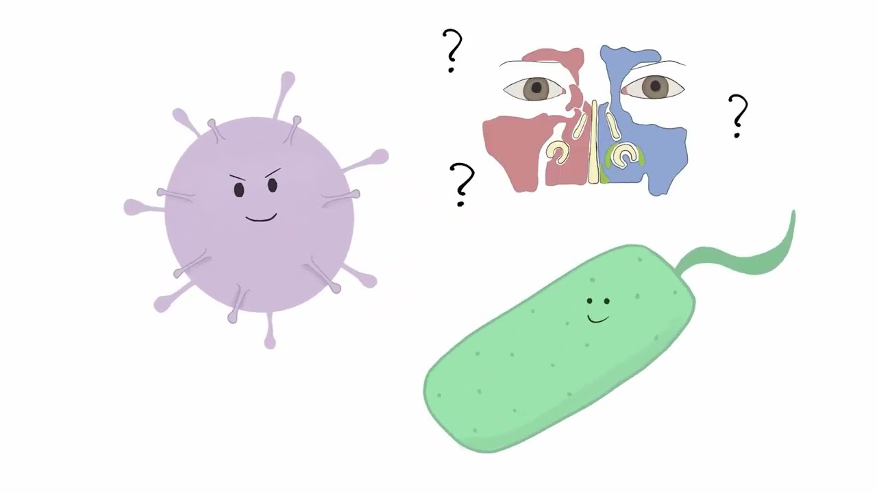 Milloin antibiootit ovat paikallaan flunssassa?