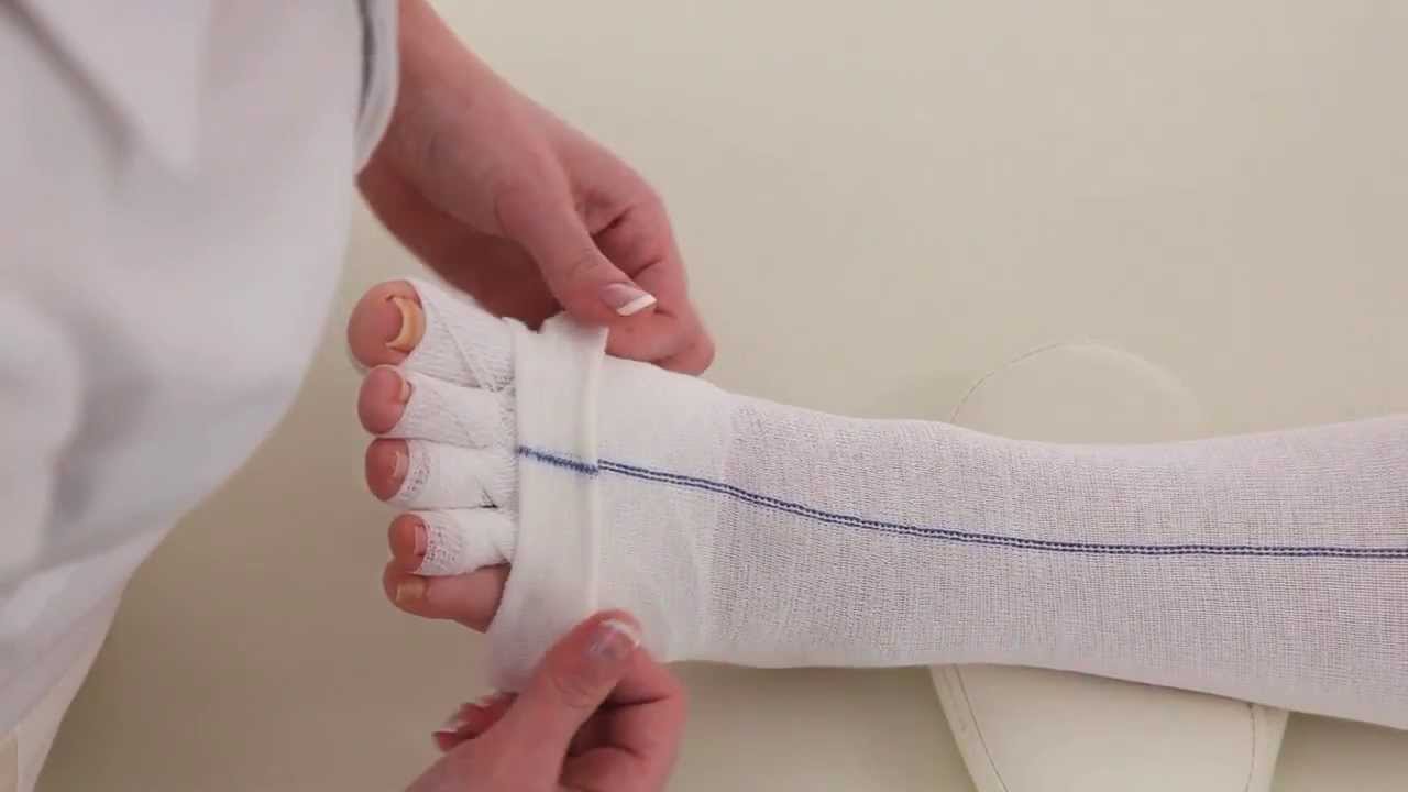 Mollelast toe bandaging
