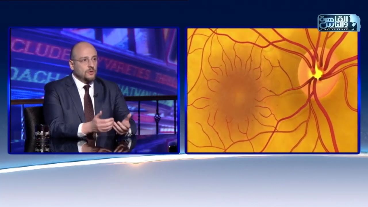 امراض شبكية العين وعلاجها مع دكتور أحمد حبيب استشاري جراحات الشبكية والجسم الزجاجي
