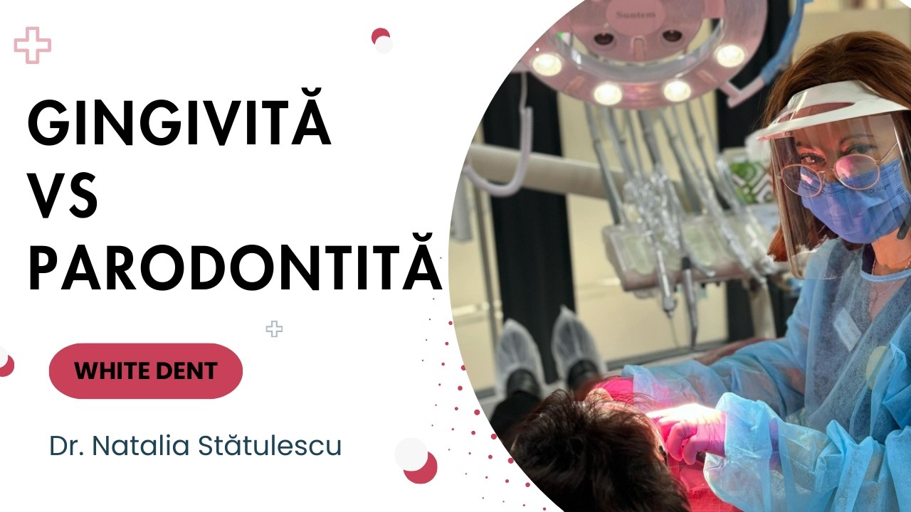 Gingivită vs Parodontită: care este diferența și când începi să pierzi dinții?