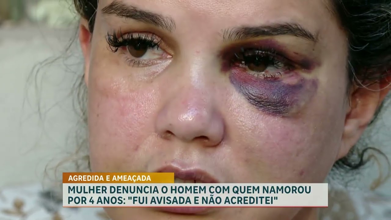 Mulher denuncia ex-namorado por agressões após quatro anos de relacionamento na Grande BH