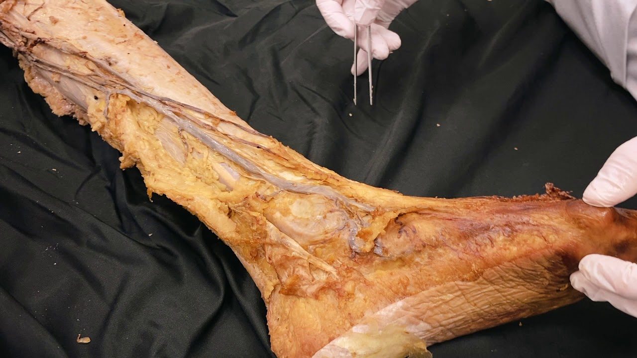 Untere Extremit&auml;t - topografische Anatomie des Menschen | Sezierkurs Live Anatomie Innsbruck