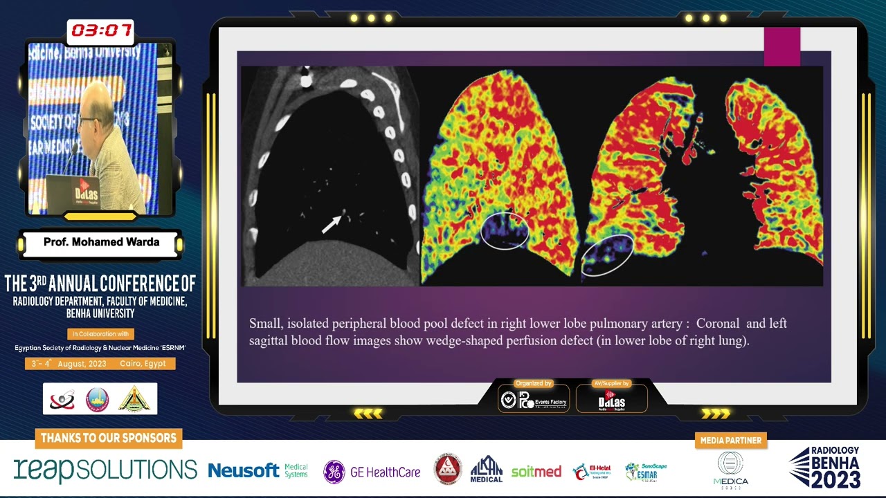 Dual Energy CT Applications In Chest Imaging