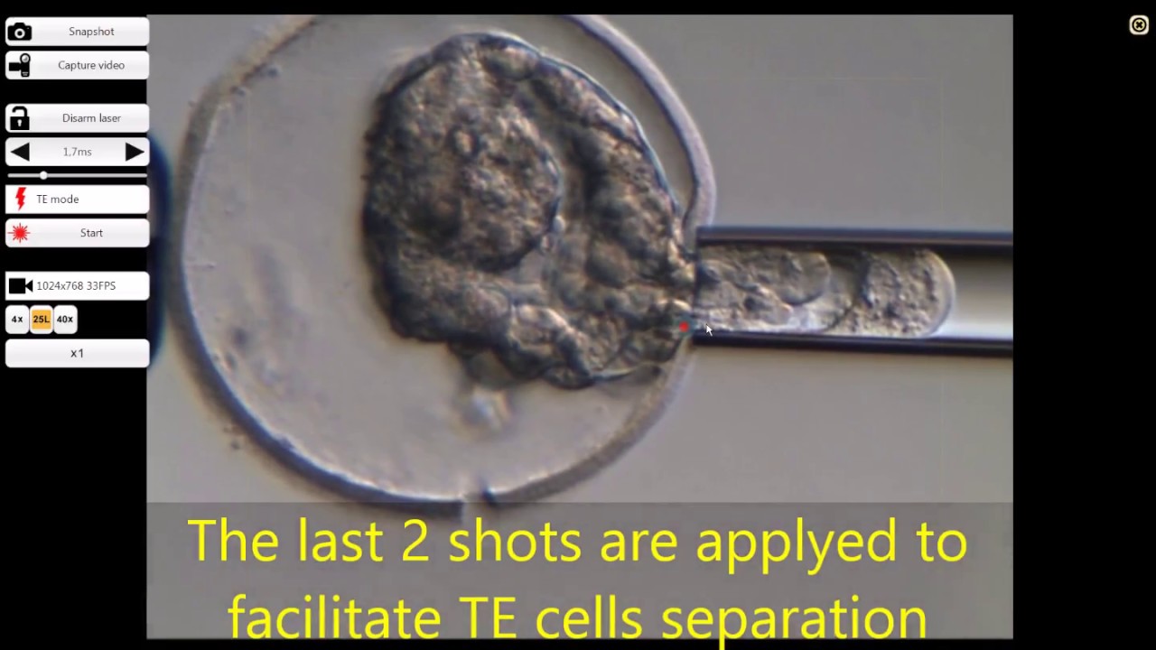 Expanded blastocyst biopsy