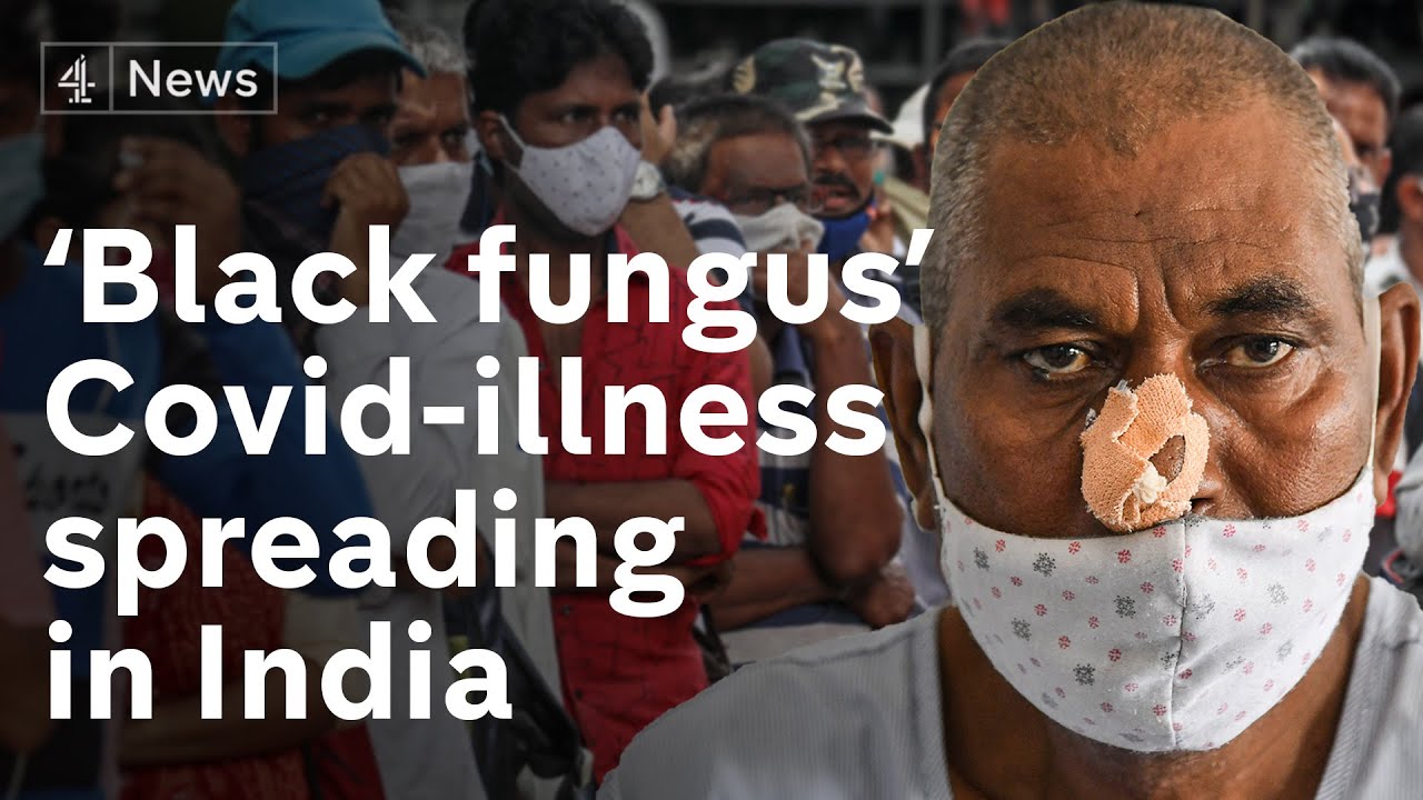 Covid-linked &lsquo;black fungus&rsquo; infection spreading in India