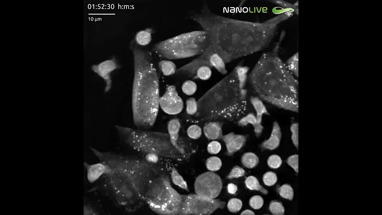 Cancer cells evade frenzied attack from T cells