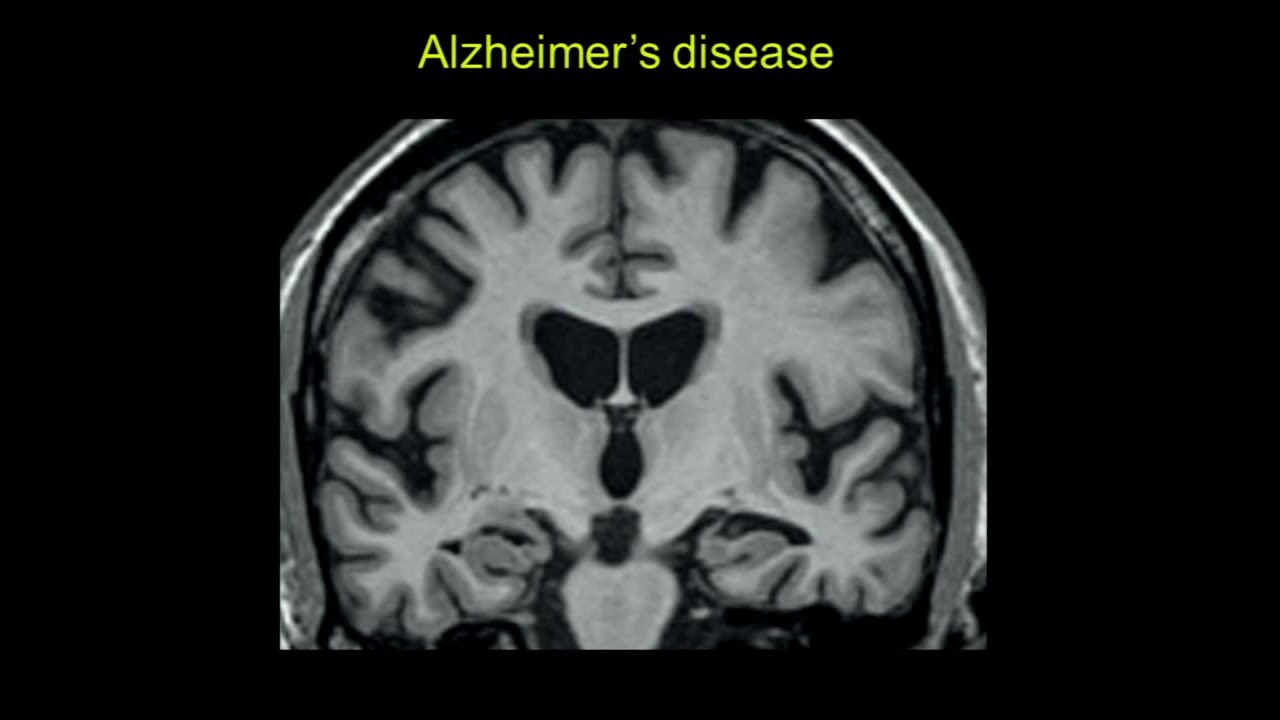 2015 FTD Annual Seminar: Imaging in FTD