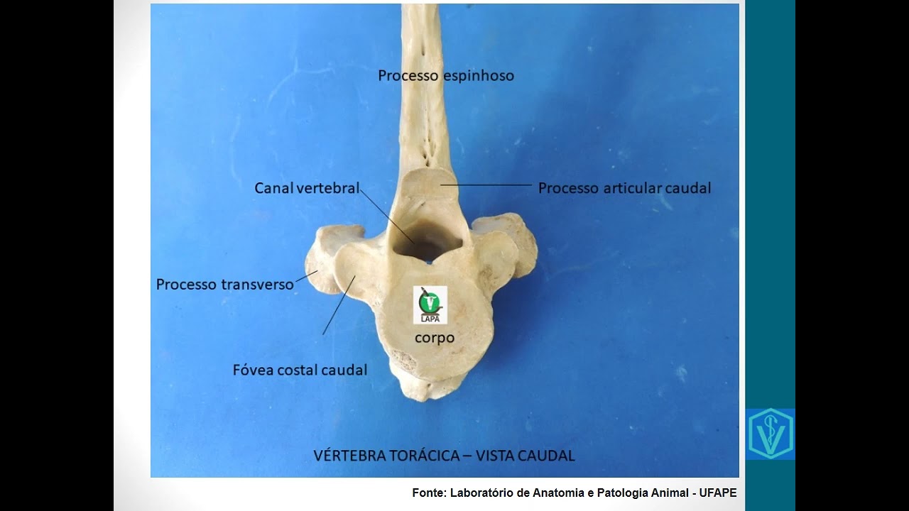 Osteologia Da Coluna Vertebral | Parte 02 | Vértebras Torácicas, Lombares e Osso Sacro
